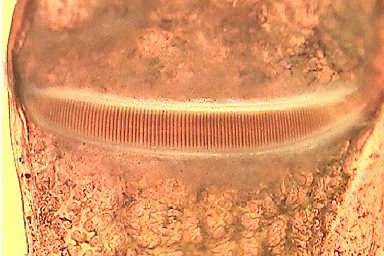 クツワムシ（オス）の左前翅 裏側 ヤスリ部分　顕微鏡拡大写真